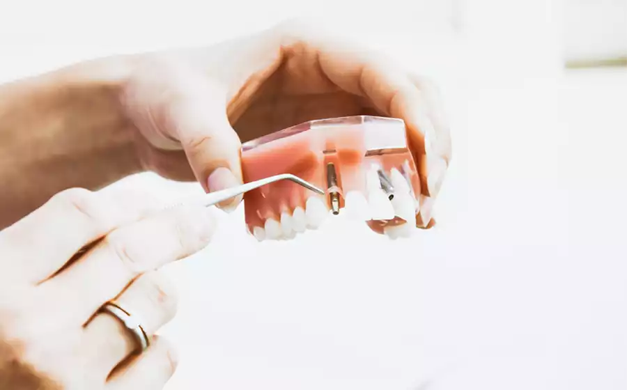 turkey dental implants